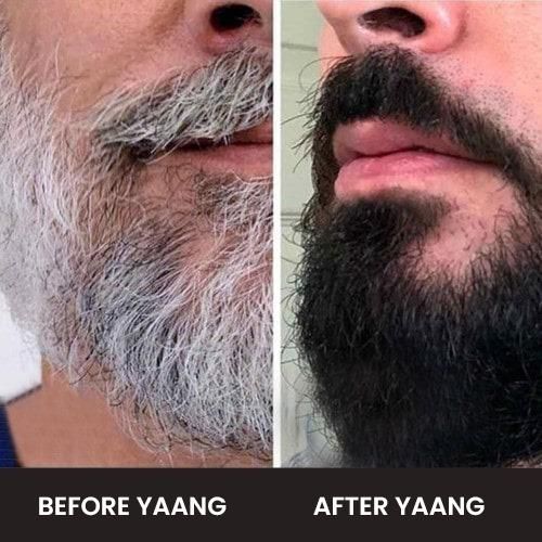 Anti Grey Beard SerumOil - Image 3