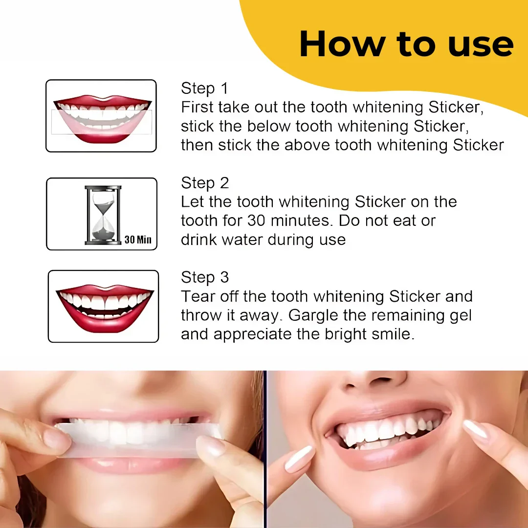 Teeth Whitening Strips - Image 3