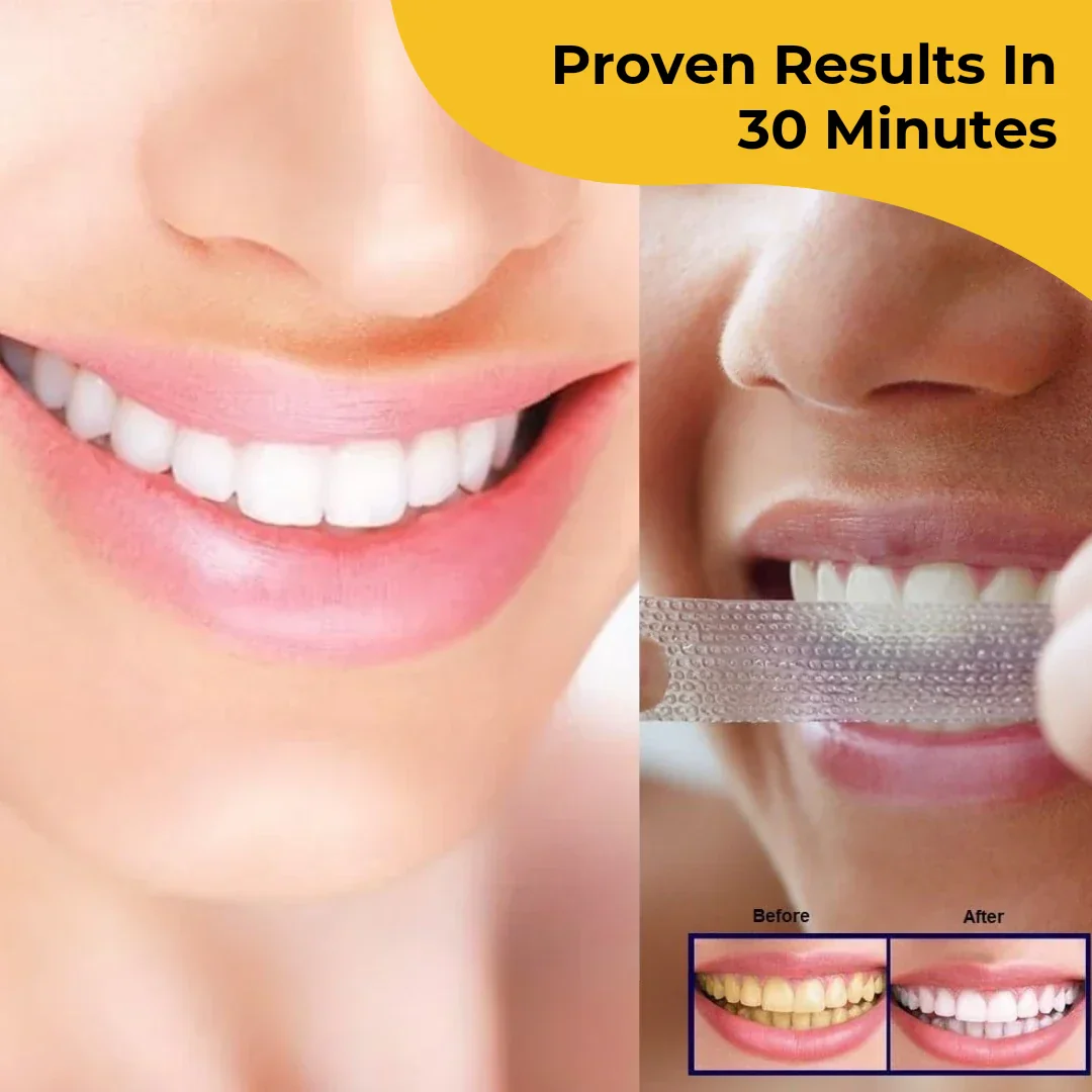 Teeth Whitening Strips - Image 4