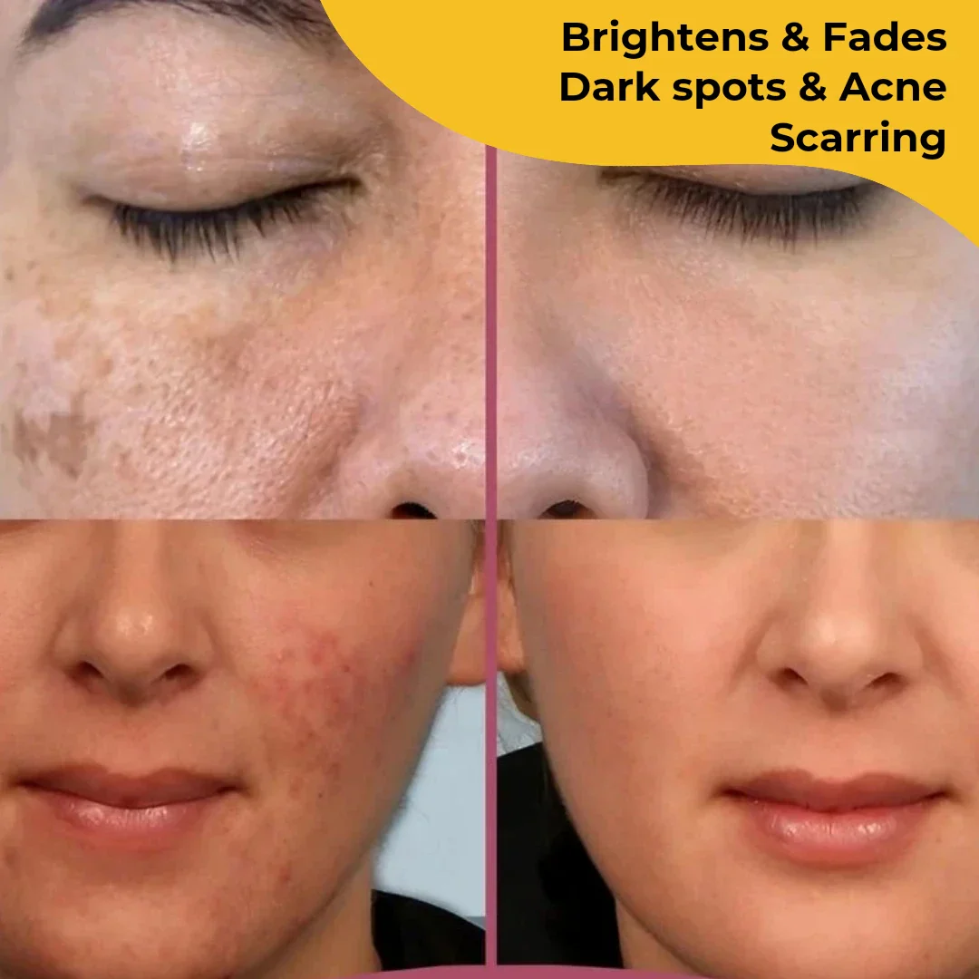 Elite Beauty Turmeric Kojic Acid Pads - Image 8