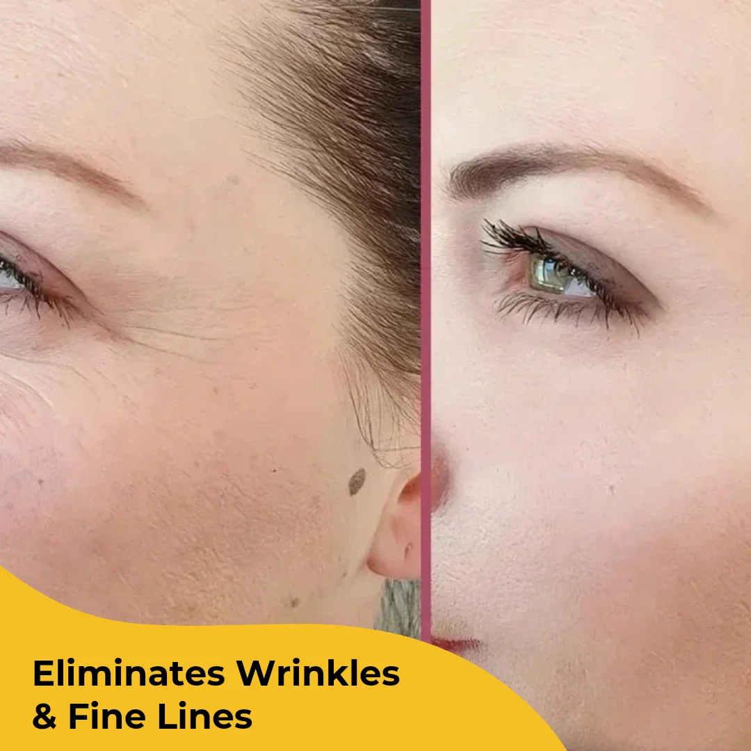 Elite Beauty Turmeric Kojic Acid Pads - Image 9