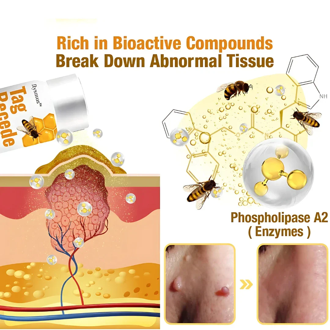 Pack of 2 ELITEPRO™ Bee Venom Tag Remover Spray - 30ml : Eliminate Warts & Skin Tags Naturally in Just 1-2 Weeks! 🐝 - Image 6