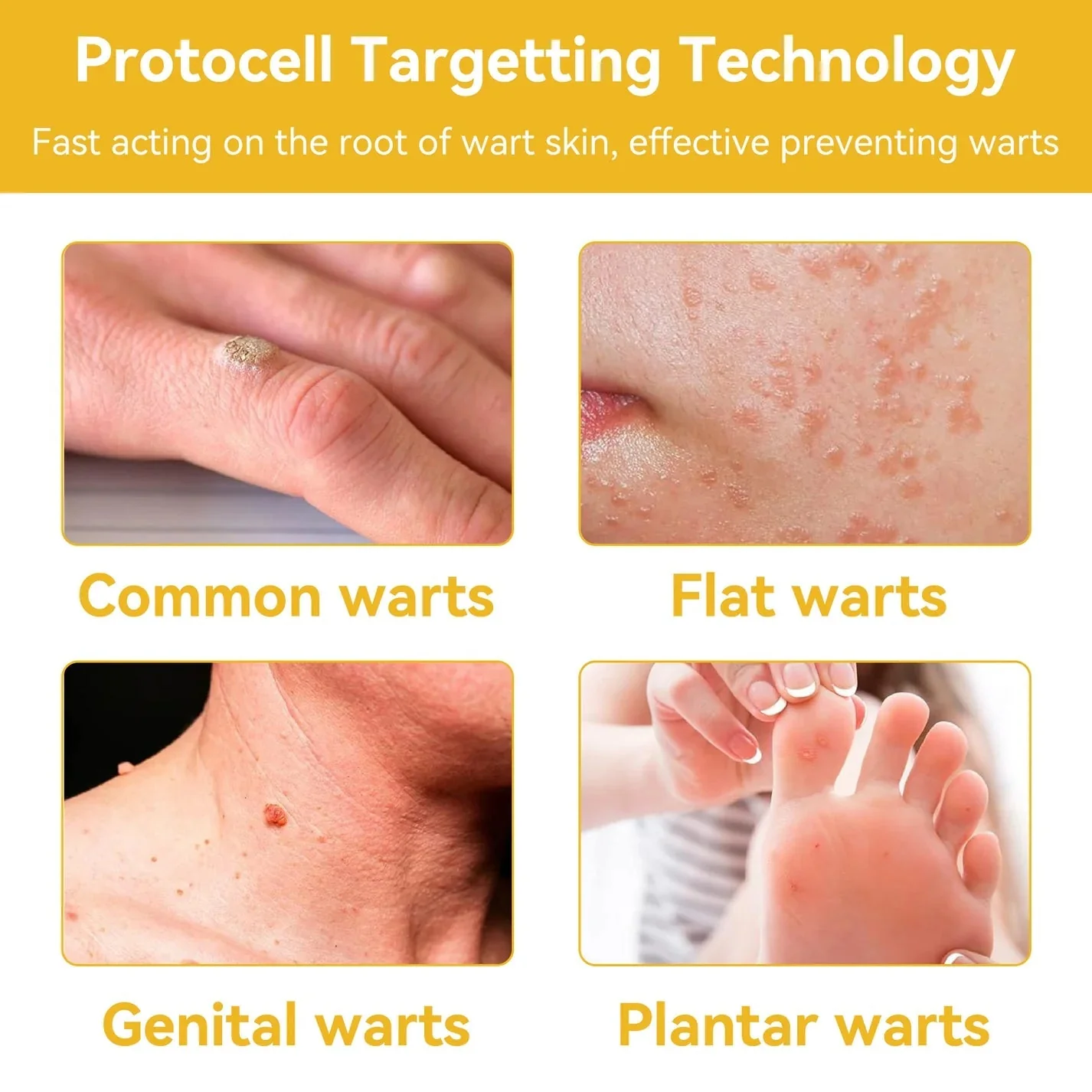 Pack of 2 ELITEPRO™ Bee Venom Tag Remover Spray - 30ml : Eliminate Warts & Skin Tags Naturally in Just 1-2 Weeks! 🐝 - Image 9