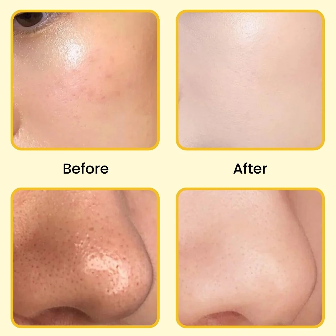 ELITEPRO™ Gold Peel off Mask - Anti-Wrinkle, 98.4% Gold, Anti-Aging, Moisturizing, Removes Blackheads, Reduces Fine Lines, Cleans Pores - Image 6