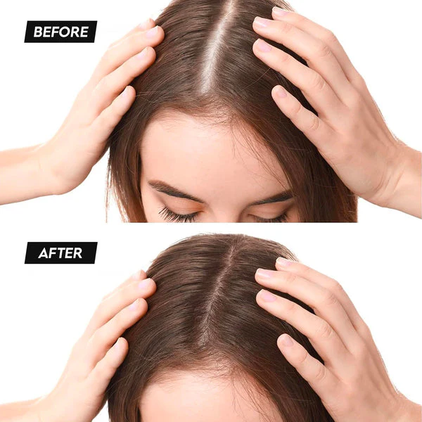 ELITEPRO™ Hair Building Fibers - Image 2